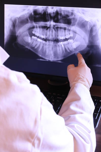 Best Emergency Treatment for Dental Infections or Abscesses in Biloxi, MS