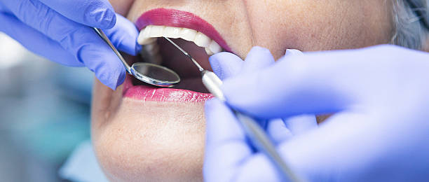 Best Emergency Treatment for Dental Infections or Abscesses in Biloxi, MS